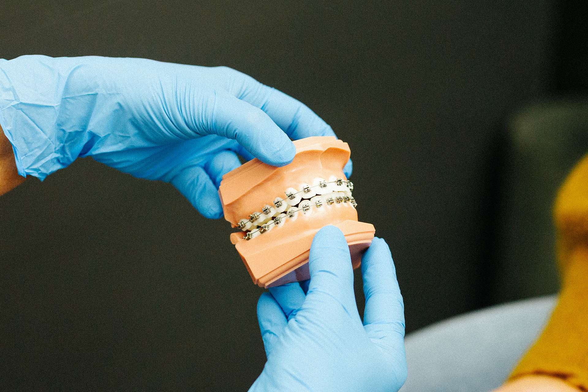 Orthodontist met beugelmodel